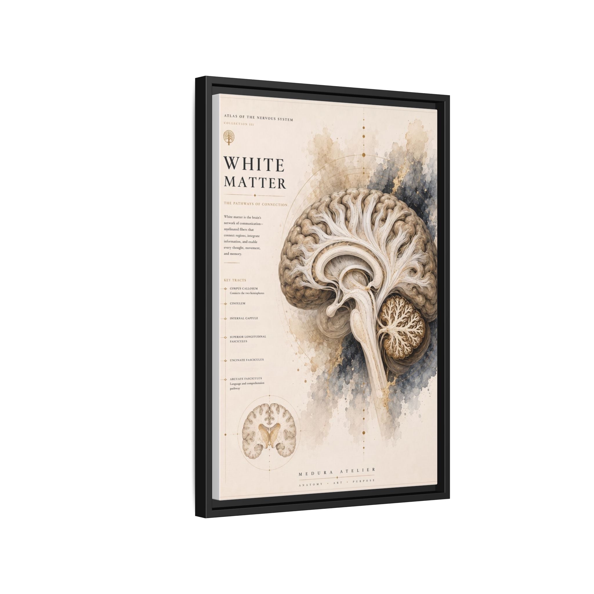 White Matter Brain Wall Art | Luxury Neuroscience Canvas Print | Museum-Inspired Fine Art