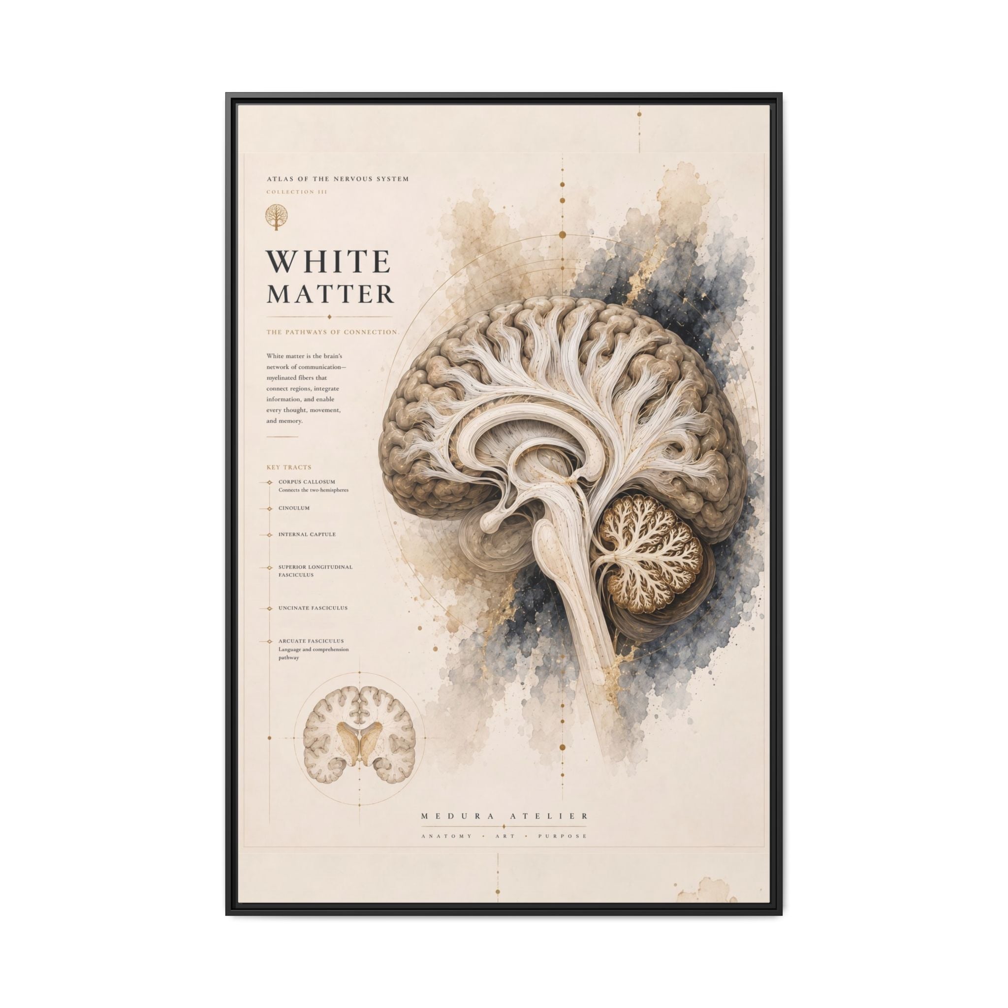 White Matter Brain Wall Art | Luxury Neuroscience Canvas Print | Museum-Inspired Fine Art