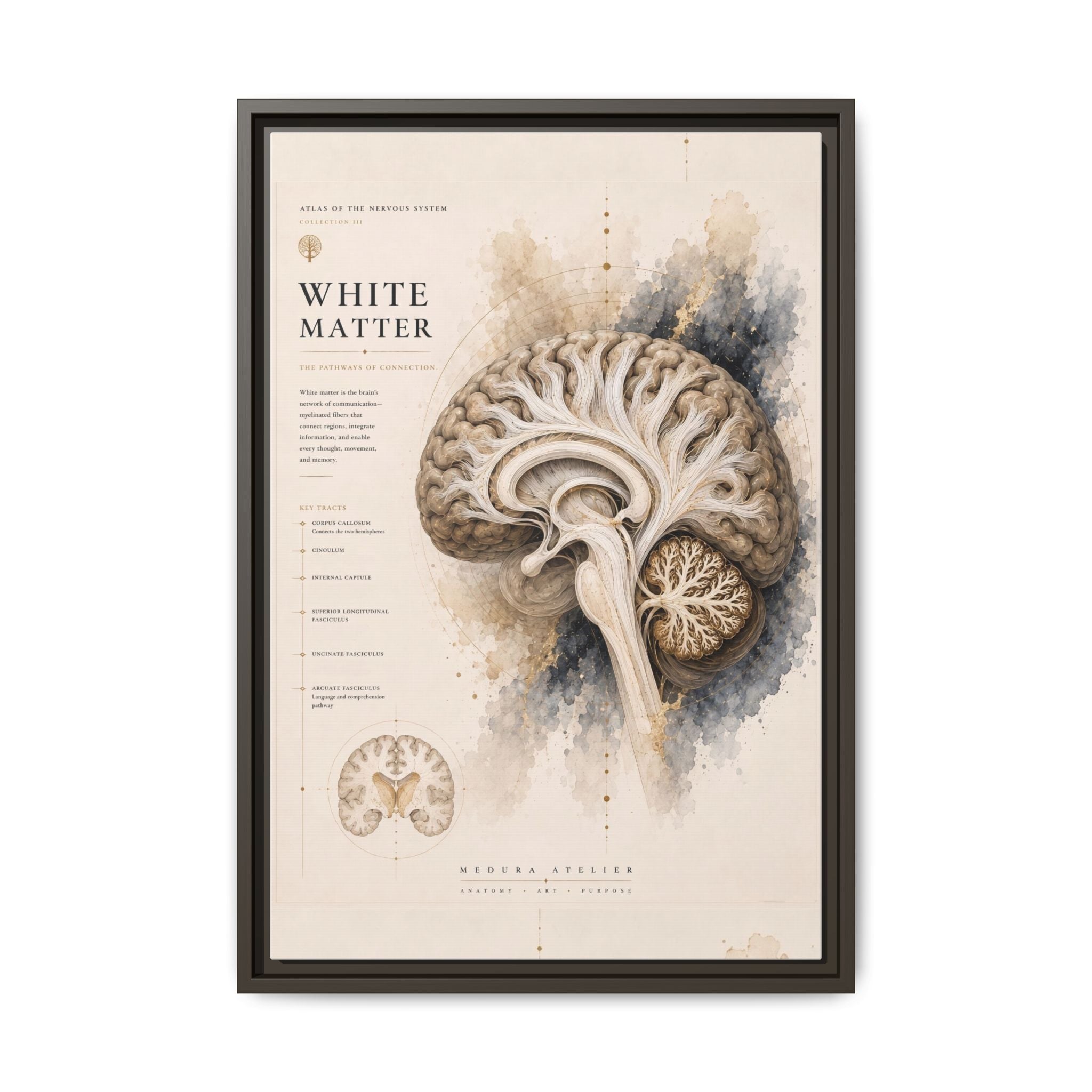 White Matter Brain Wall Art | Luxury Neuroscience Canvas Print | Museum-Inspired Fine Art
