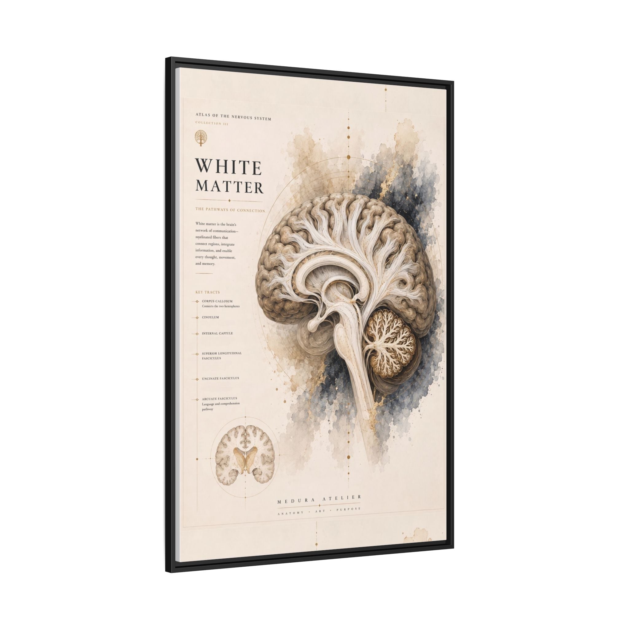White Matter Brain Wall Art | Luxury Neuroscience Canvas Print | Museum-Inspired Fine Art