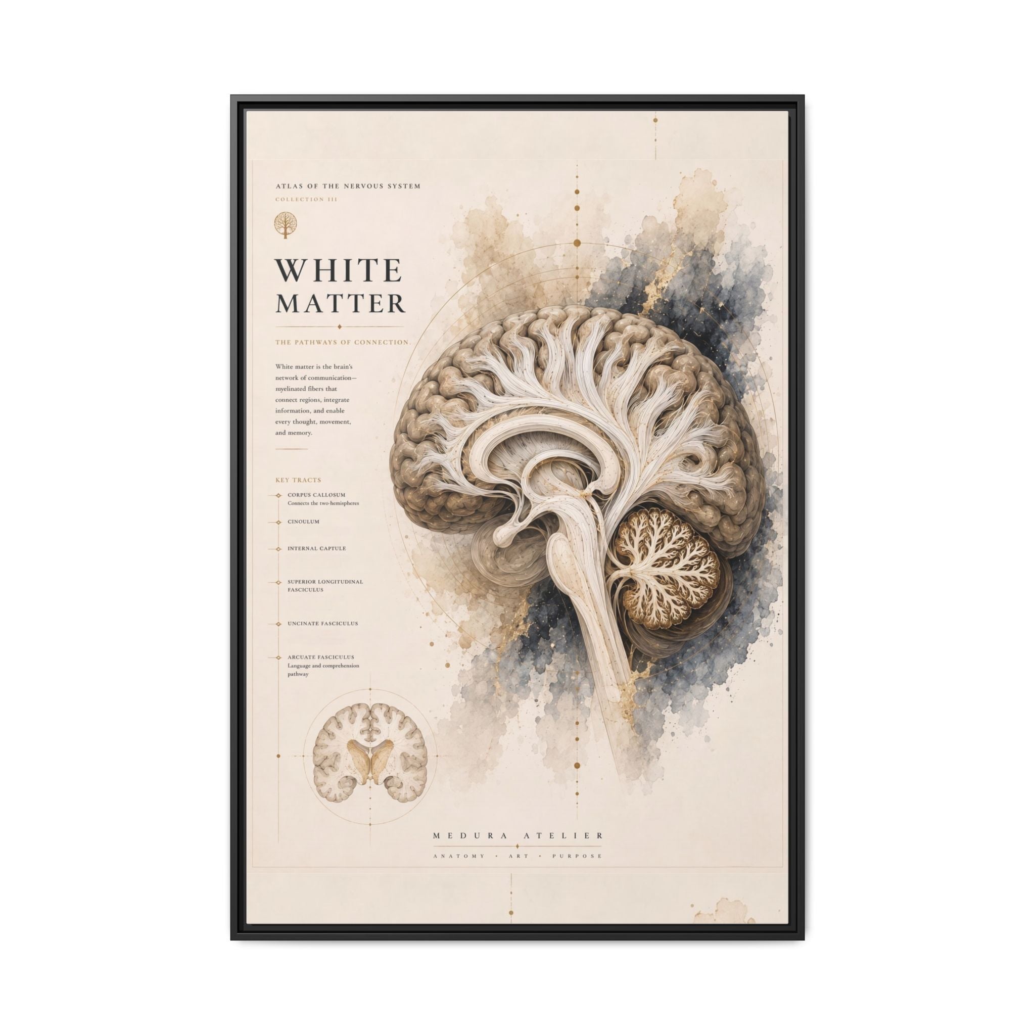 White Matter Brain Wall Art | Luxury Neuroscience Canvas Print | Museum-Inspired Fine Art
