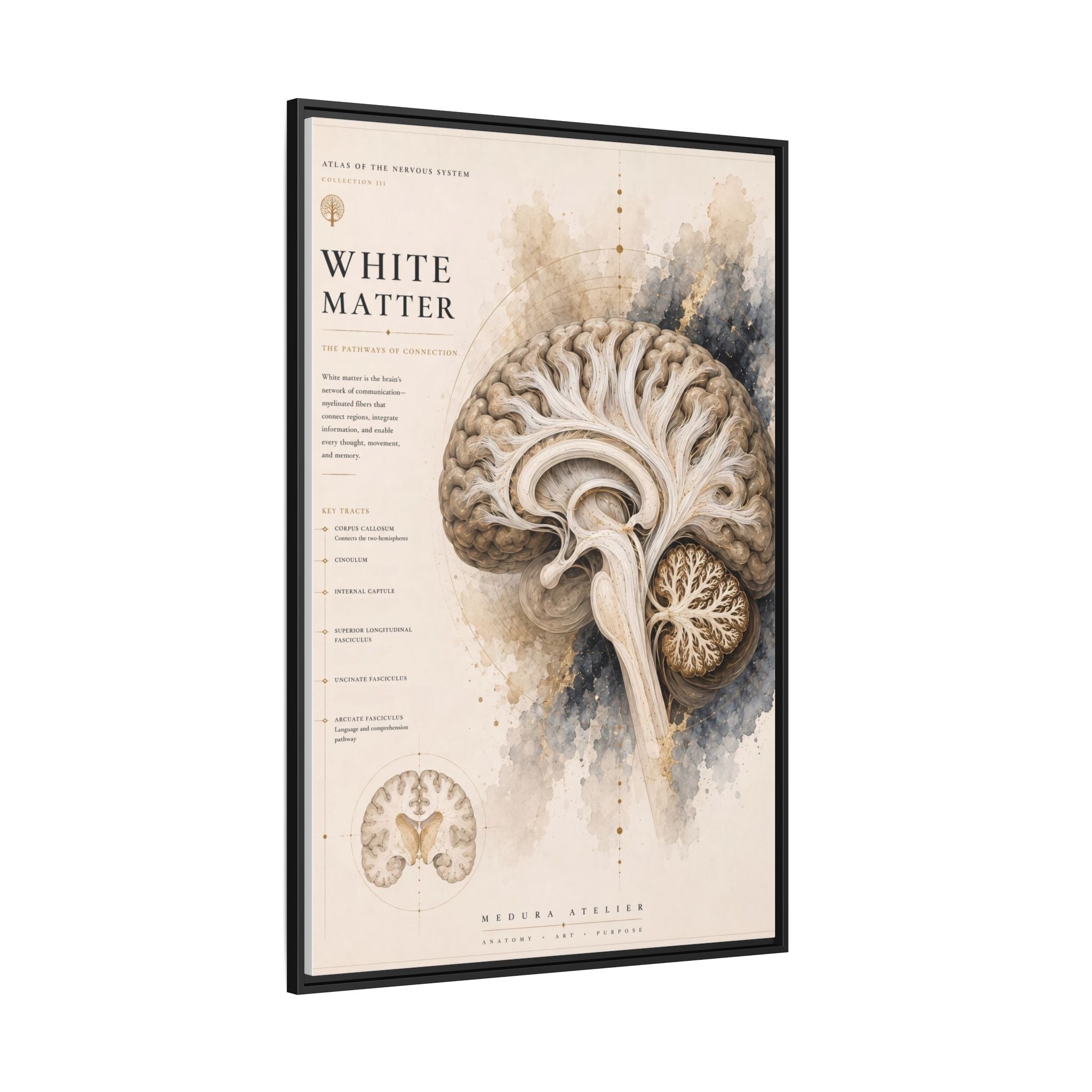 White Matter Brain Wall Art | Luxury Neuroscience Canvas Print | Museum-Inspired Fine Art