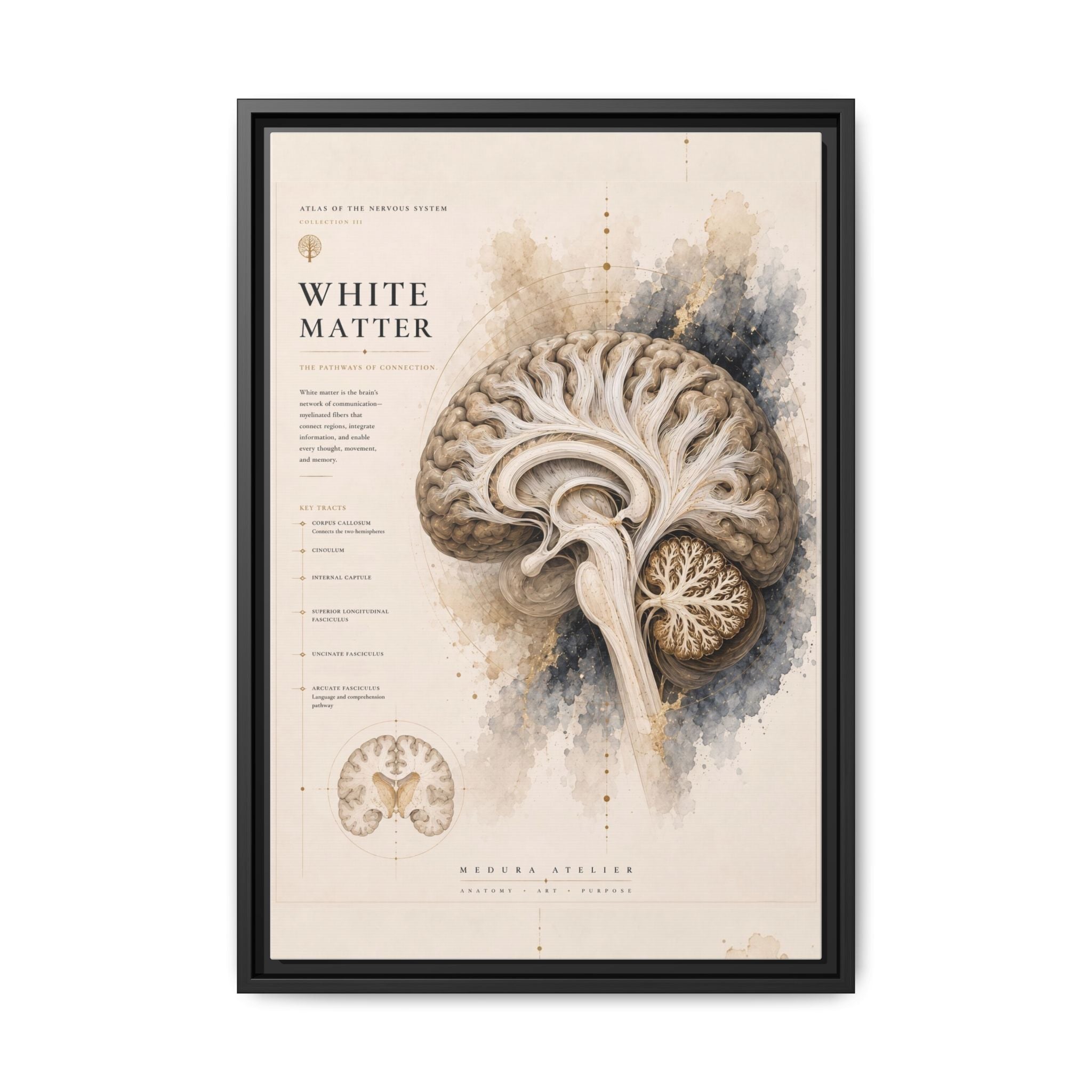 White Matter Brain Wall Art | Luxury Neuroscience Canvas Print | Museum-Inspired Fine Art
